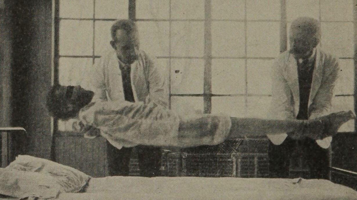 Un caso straordinario di rigidità catatonica. Sostenuto solo dalle spalle e dai piedi, il corpo è completamente sospeso a mezz'aria, 1915