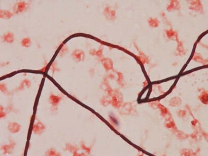 Bacillus anthracis