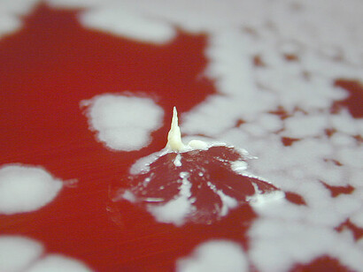 Cultivo de «Bacillus anthracis»
