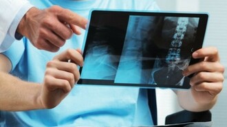 Un médico revisa con su paciente una radiografía