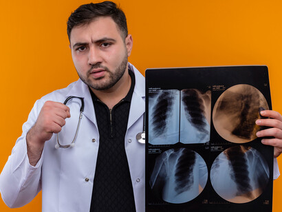 radiografia dos pulmões. Adolescentes: seus pulmões ainda estão em desenvolvimento e podem ser mais facilmente danificados pelas substâncias presentes no vapor