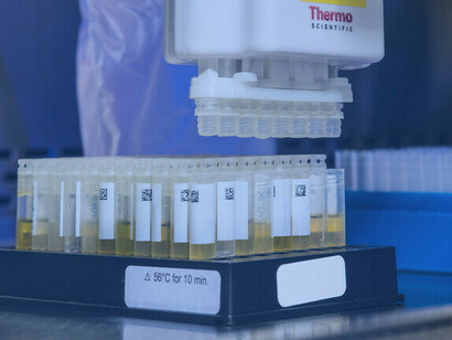 Der Influenza, der Grippe, wird viel weniger Aufmerksamkeit geschenkt