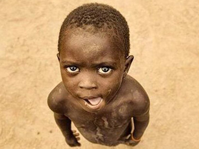 Pasar hambre es una de las experiencias más devastadoras que existen