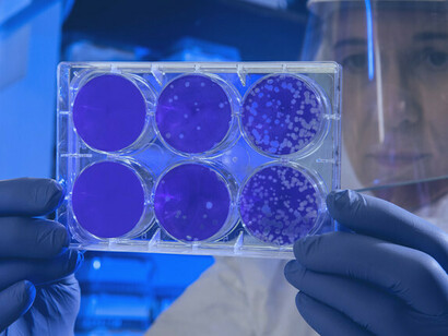 La COVID-19 y la influenza plantean graves amenazas para millones de personas