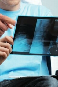 Un médico revisa con su paciente una radiografía