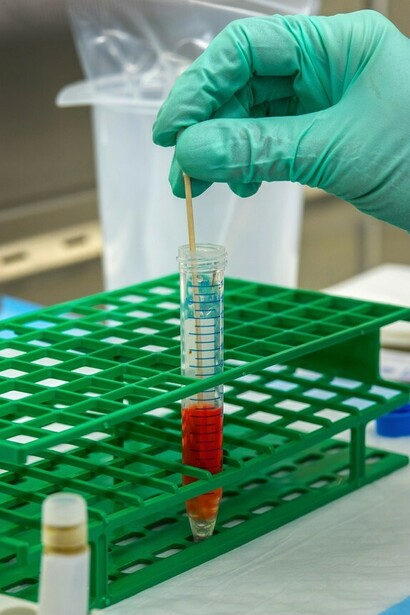 La vacuna de Pfizer debe almacenarse a -75 °C