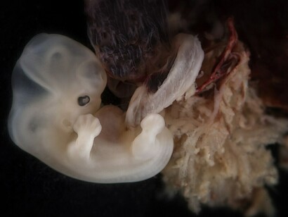 Embrione a circa 6 settimane dal concepimento