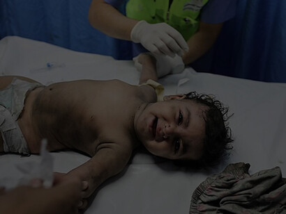 Wounded Palestinians wait for treatment at the overcrowded emergency ward of Al-Shifa hospital in Gaza City following an Israeli airstrike on October 11, 2023