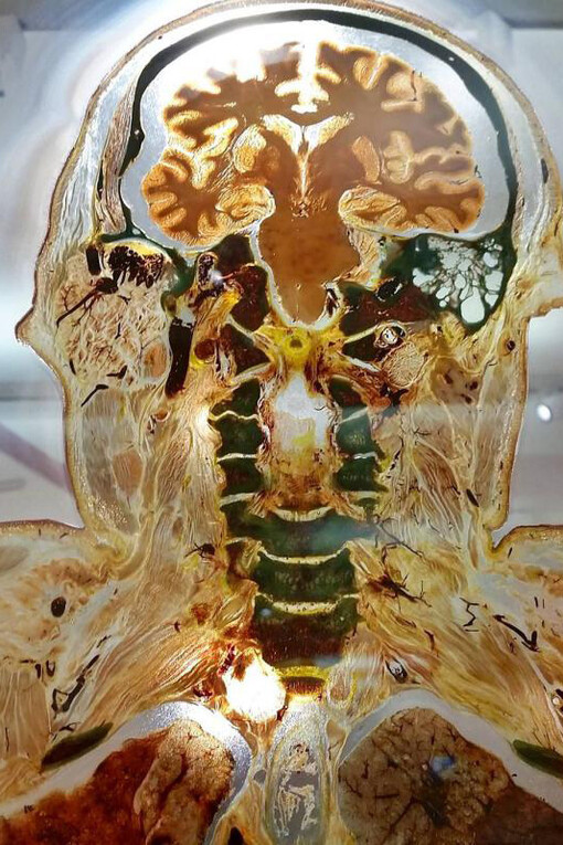 Medicine Now. Courtesy of Wellcome Collection 