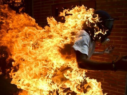 Un hombre se quemó accidentalmente durante las protestas 