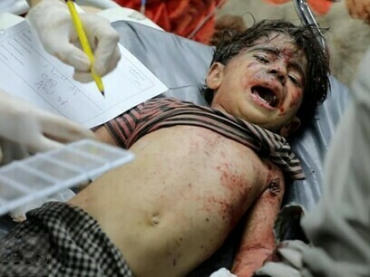 Les attaques israéliennes se sont intensifiées après le 7 octobre 2023. Sur la photo, un enfant blessé lors d'un raid aérien sur la bande de Gaza. Photo de Ghassan Salem