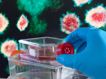 In Germany, testing for the Coronavirus is free at the point of use under both statutory and private health insurance