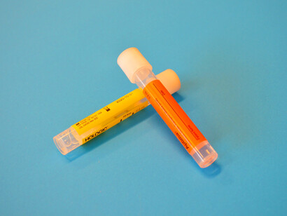 No se trata de exigirle a la ciencia respuestas que no están en su horizonte ni en sus métodos, pero ante graves exigencias, como la pandemia, se obtuvieron soluciones en tiempos realmente extraordinarios