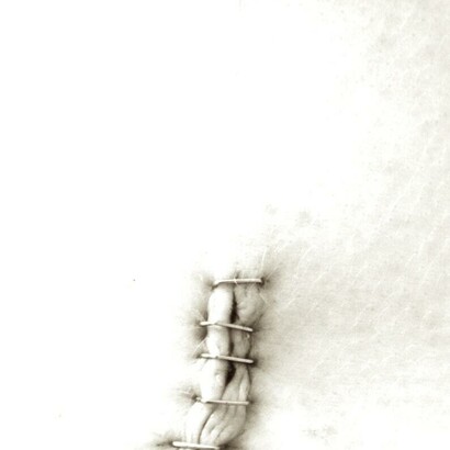 Cicatrices del cuerpo y del alma