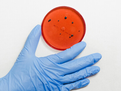 A hand in plastic gloves moving a medical sample