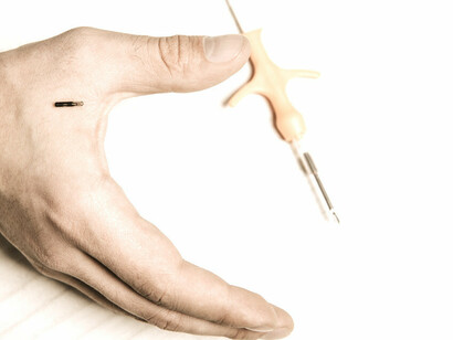 Implantes de microchip: ficção ou realidade?