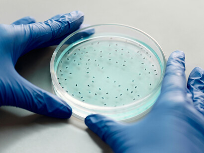 Las bacterias son microorganismos esenciales para el equilibrio ecológico y participan en procesos como la descomposición y la fijación del nitrógeno