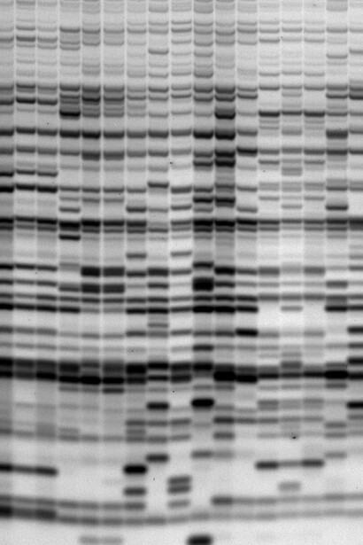 Representación tradicional de una secuencia de ADN