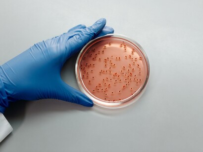 A person wearing gloves looking at an agar plate 