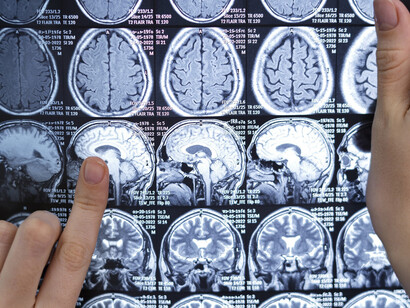 A doctor analyzing a patient brain scans