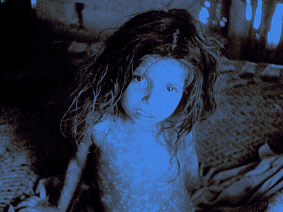 Niña infectada de Viruela