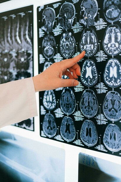 Una studiosa osserva le lastre di un cervello. Le radici dell'intuito possono essere rintracciate nella memoria implicita, che è la capacità del cervello di accumulare informazioni attraverso esperienze passate senza necessariamente ricordare consapevolmente i dettagli