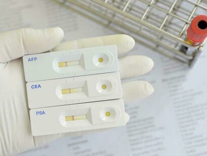 El desarrollo de la tecnología no implica la derrota del cáncer, sino, a lo sumo, su conversión en enfermedad crónica