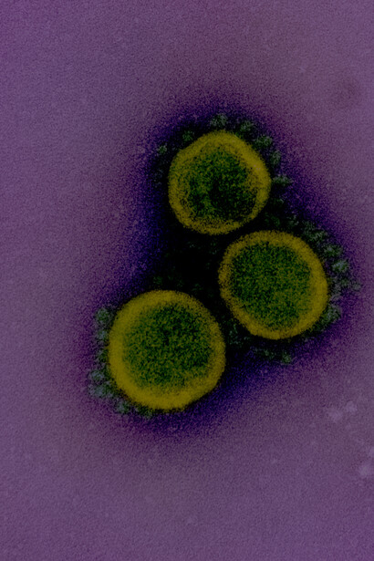 Micrografía electrónica de transmisión de viriones de SARS-CoV-2 aislados desde un paciente y coloreada para resaltar los virus