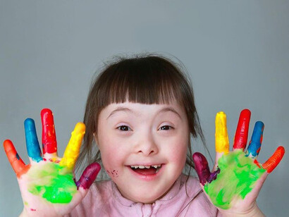 Al contrario de lo que pasaba en los medios de comunicación las publicaciones científicas informaban de que algunos colectivos eran especialmente sensibles a las consecuencias de la infección por SARSCoV-2 como en el caso de los pacientes con síndrome de Down