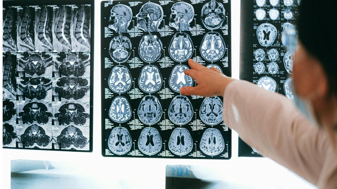 Una studiosa osserva le lastre di un cervello