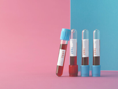 Muchas condiciones médicas en mujeres son malinterpretadas o atribuidas a factores psicológicos, como ansiedad o estrés, en lugar de investigarse a profundidad