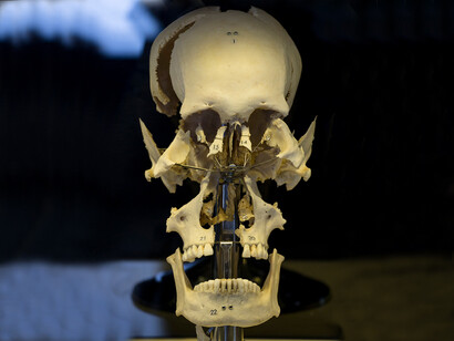 Human Bodies. Cráneo humano
