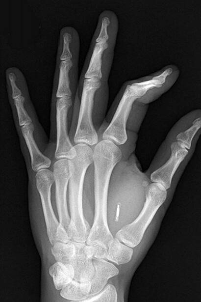 Las neuroarmas sirven para influir directamente sobre la conducta humana a través de la alteración de funciones del sistema nervioso central