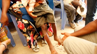 La ayuda del Reino Unido ha ayudado a "Acción contra el Hambre" a reducir los niveles de desnutrición en el distrito de Masi Manimba, donde muchas familias siguen siendo vulnerables y tienen dificultades para costear o acceder a una dieta básica saludable.Un niño es examinado para detectar signos de desnutrición en el hospital general local de Masi Manimba, República Democrática del Congo