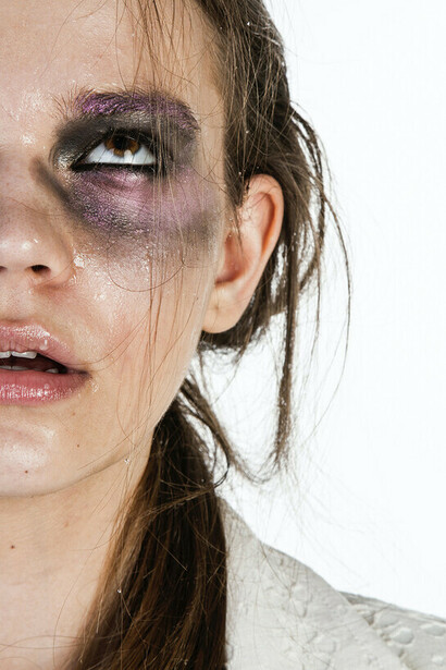 Denuncia. Occorre sconfiggere l’ignoranza che ancora esiste in molte famiglie sulla conoscenza dei segnali che preannunziano gli atti di violenza, affinché possano essere posti i necessari rimedi, anche attraverso una denuncia preventiva all’autorità giudiziaria, nella consapevolezza che quella denuncia potrà salvare la vita della donna vittimizzata