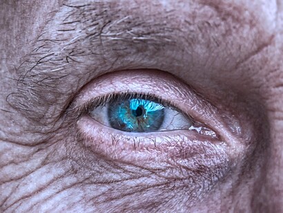 El ojo de la edad 