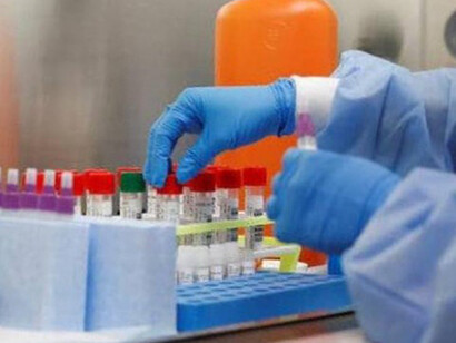 Diagnostic tests look for the presence of viral antigens in the blood and/or saliva