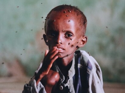 Starving child in Mogadishu
