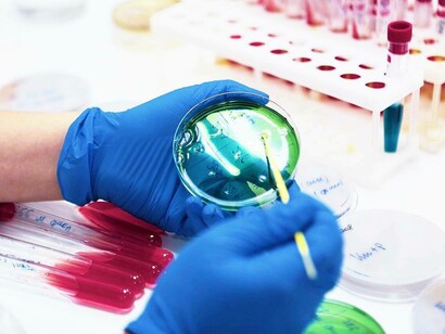 Capsula di Petri in laboratorio, fondamentale strumento di lavoro in molti campi della biologia, per la crescita di colture cellulari e per osservare a occhio nudo colonie batteriche