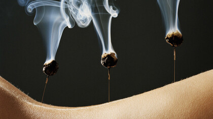 The Origin of Acupuncture & Moxibustion