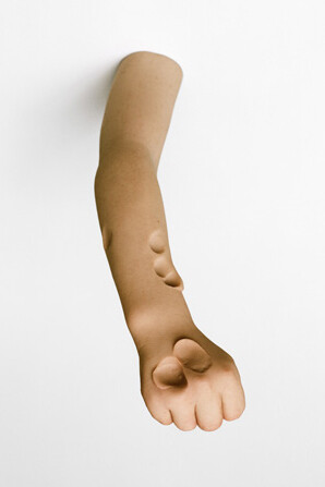 Show Me Your wound. Courtesy of Dom Museum Wien 