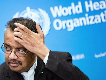 World Health Organization Director-General Tedros Adhanom Ghebreyesus scratching his forehead
