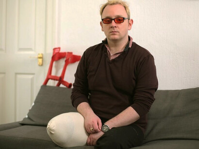 Body Untegrity Identity Disorder