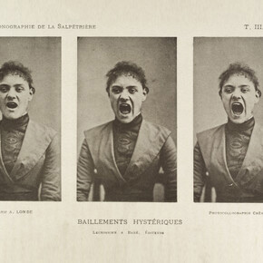 Three photos in a series showing Early animated picture by John Arthur Roebuck Rudge depicting the face of William Friese-G a hysterical woman yawning