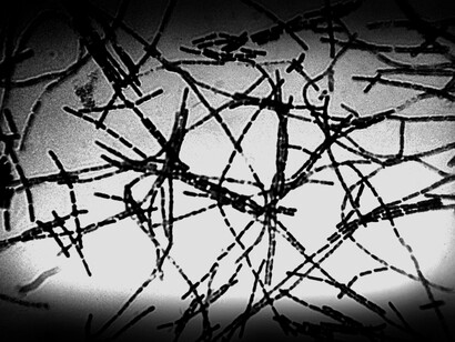 Maladie du charbon. La recette finale consiste à cultiver le bacille à 42-43°C pendant huit jours, tout en oxygénant les cultures, et en appliquant le traitement au phénol