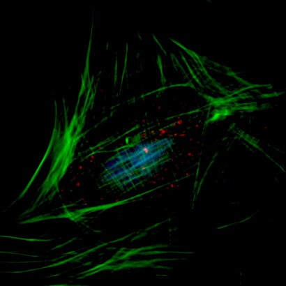 Imagen de microscopio confocal de un fibroblastos que muestra el núcleo (azul), las mitocondrias (rojo) y el citoesqueleto de actina (verde)