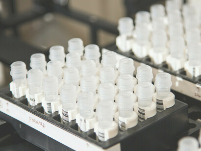 Frascos com amostras de DNA