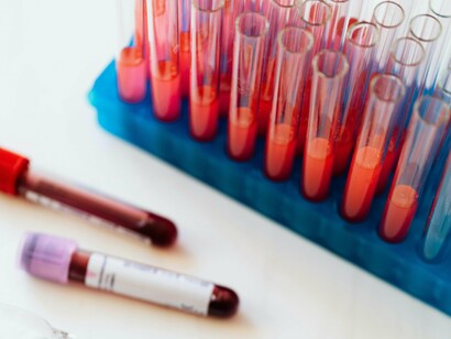 Tubos de ensaio com amostras de sangue. Ao contrário dos exames de sangue, as doações de sangue não são feitas em jejum; ao contrário, se recomenda comer bem (preferentemente uma alimentação baixa em gordura e em lácteos, mas isso varia em cada hemocentro) e tomar muito líquido no dia da doação