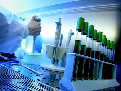 Test di laboratorio