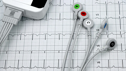 Um relato emocionante de um episódio de mal-estar repentino, destacando a importância de reconhecer os sinais de alerta e buscar cuidados médicos imediatos para prevenir complicações graves